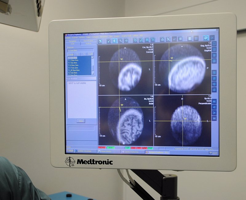 My brain in all it's glory